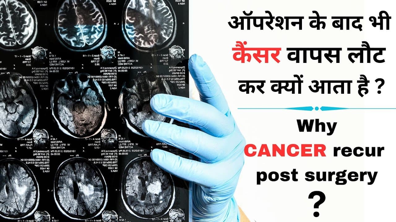 ऑपरेशन के बाद भी कैंसर वापस लौट कर क्यों आता है ?