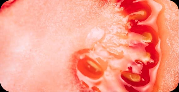 Oral Melanoma and Other Rare Types