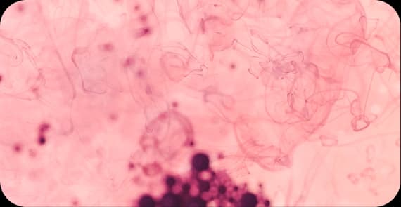 Squamous Cell Carcinoma