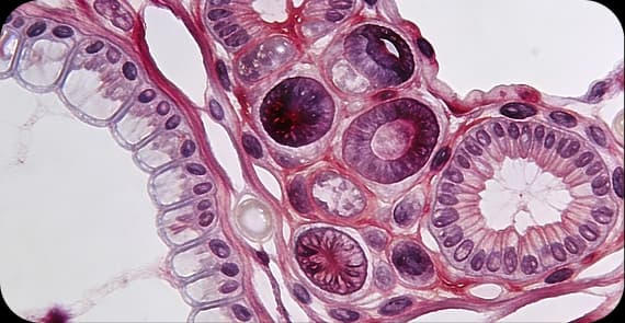 Pharyngeal Cancer