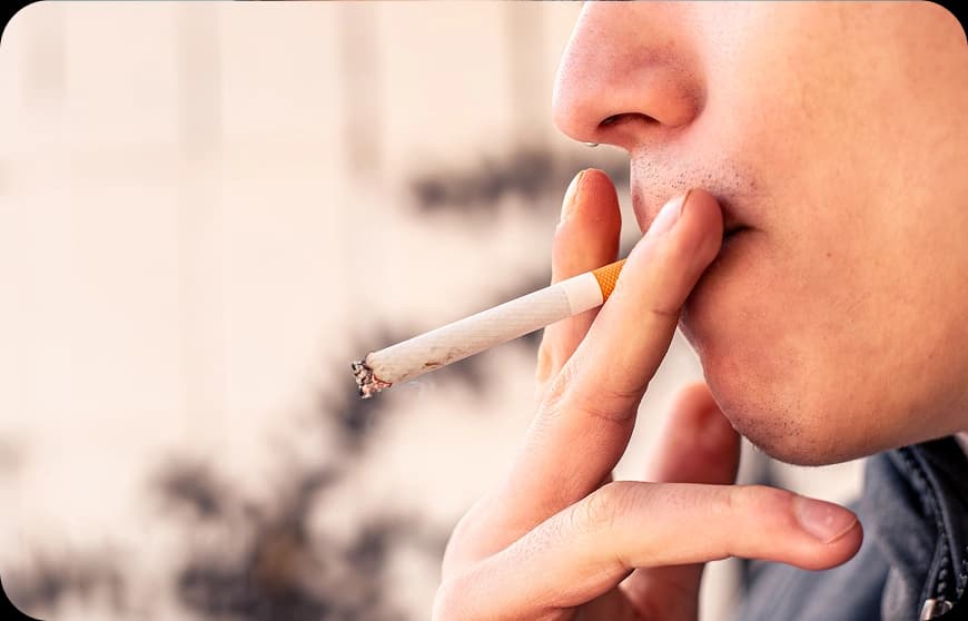 Risk Factors for Tongue Cancer