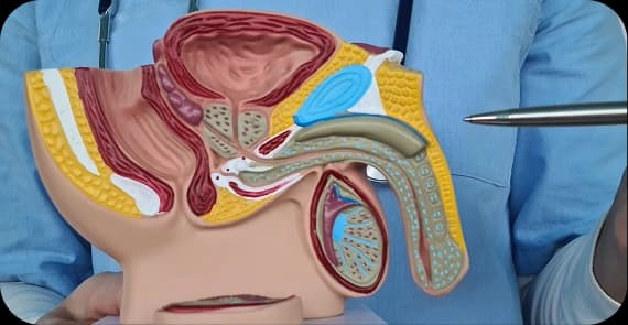 Testicular Mesothelioma
