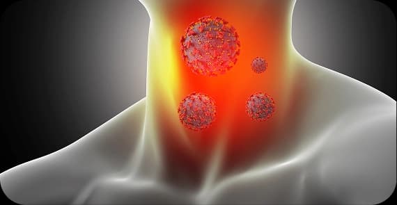 Minor Salivary Gland Cancers