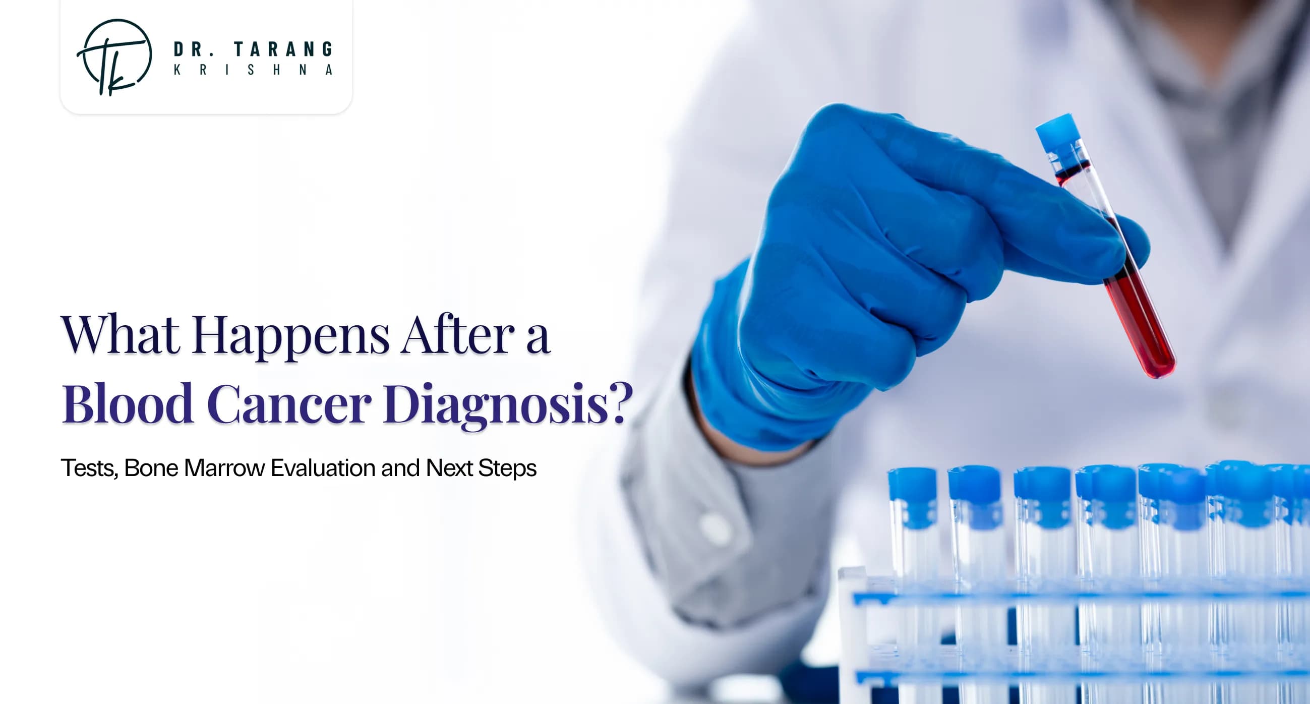 Blood Cancer Diagnosis: Blood Tests