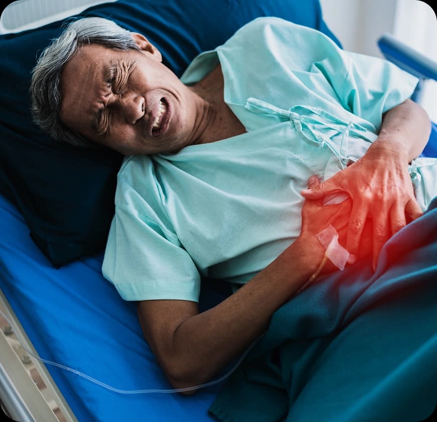 What Are the Symptoms of Colon Cancer?