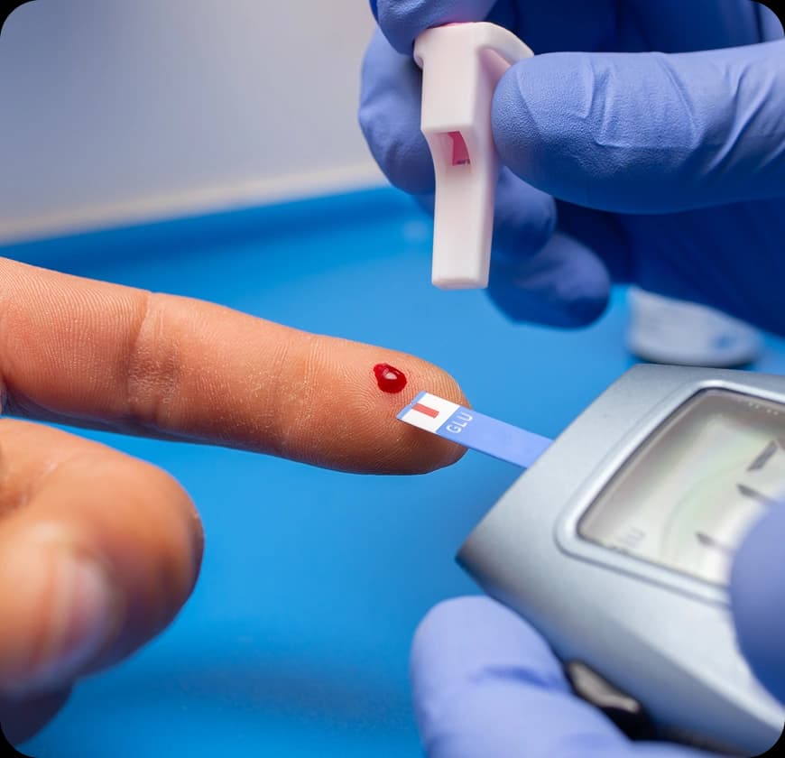 What are the causes & risk factors of Pancreatic Cancer?