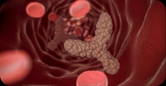 Neuroendocrine Tumours