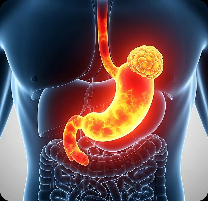 What are the causes & risk factors of stomach cancer?