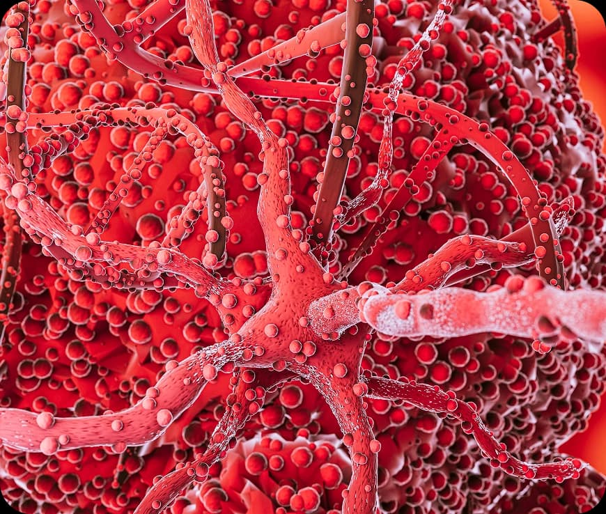 Pancreatic Cancer Stages Explained