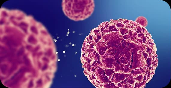 Transitional Cell Carcinoma